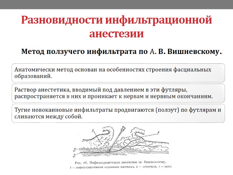 Разновидности инфильтрационной анестезии Метод ползучего инфильтрата по А. В. Вишневскому.